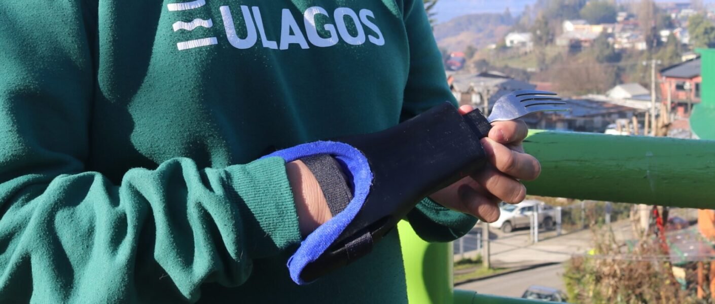 Protesis Universidad de Los Lagos