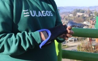 Protesis Universidad de Los Lagos