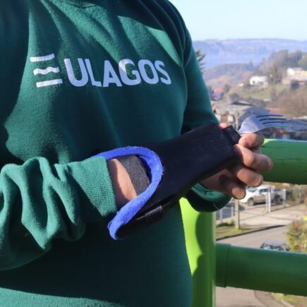 Protesis Universidad de Los Lagos